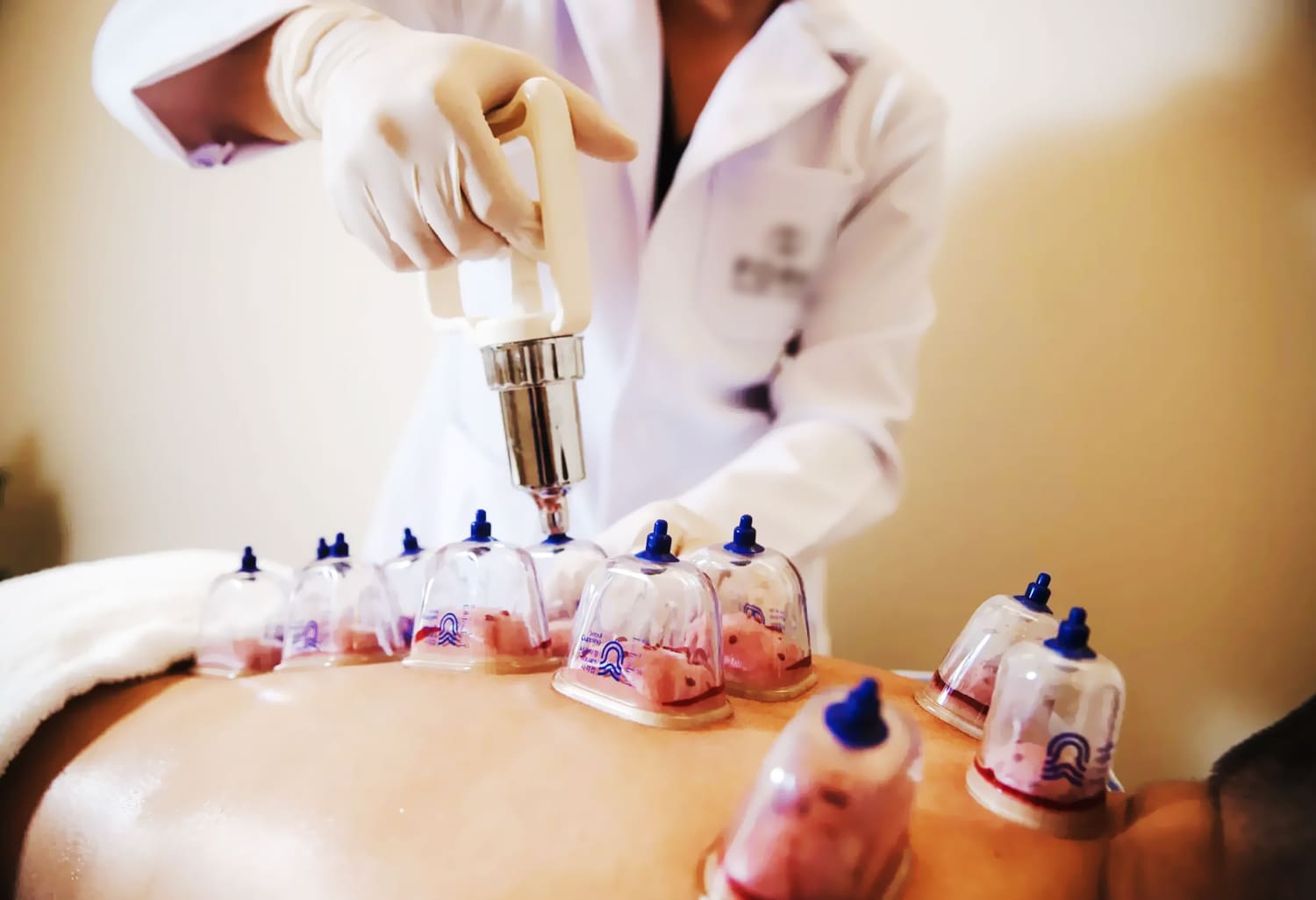 Tubuh Penuh Keluhan Tapi Masih Cari Bekam dan Ruqyah Murah Meriah Serta Asal-asalan?